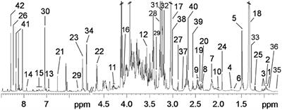 Nuclear Magnetic Resonance-Based Metabolomic Analysis Reveals Physiological Stage, Breed, and Diet Effects on the Intramuscular Metabolism of Amino Acids and Related Nutrients in Pigs